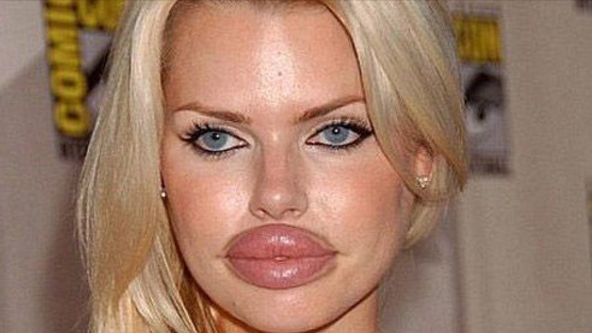 lip plastic surgery lip plastic surgery