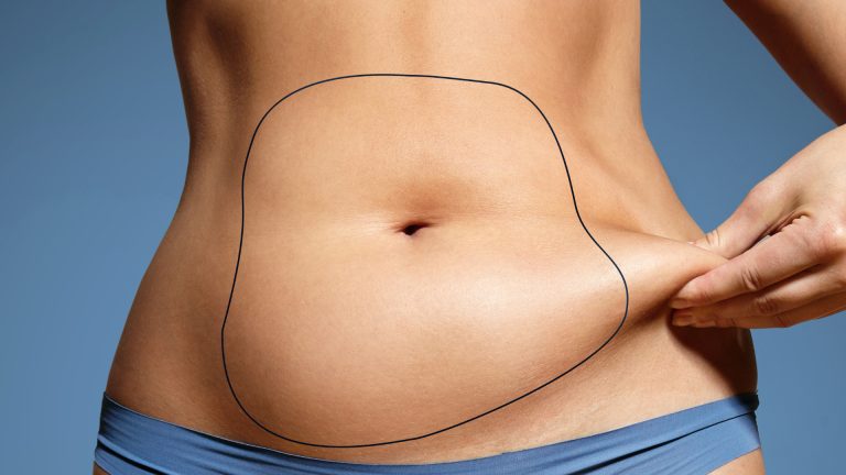 Liposuction Belly: Reshaping the midsection