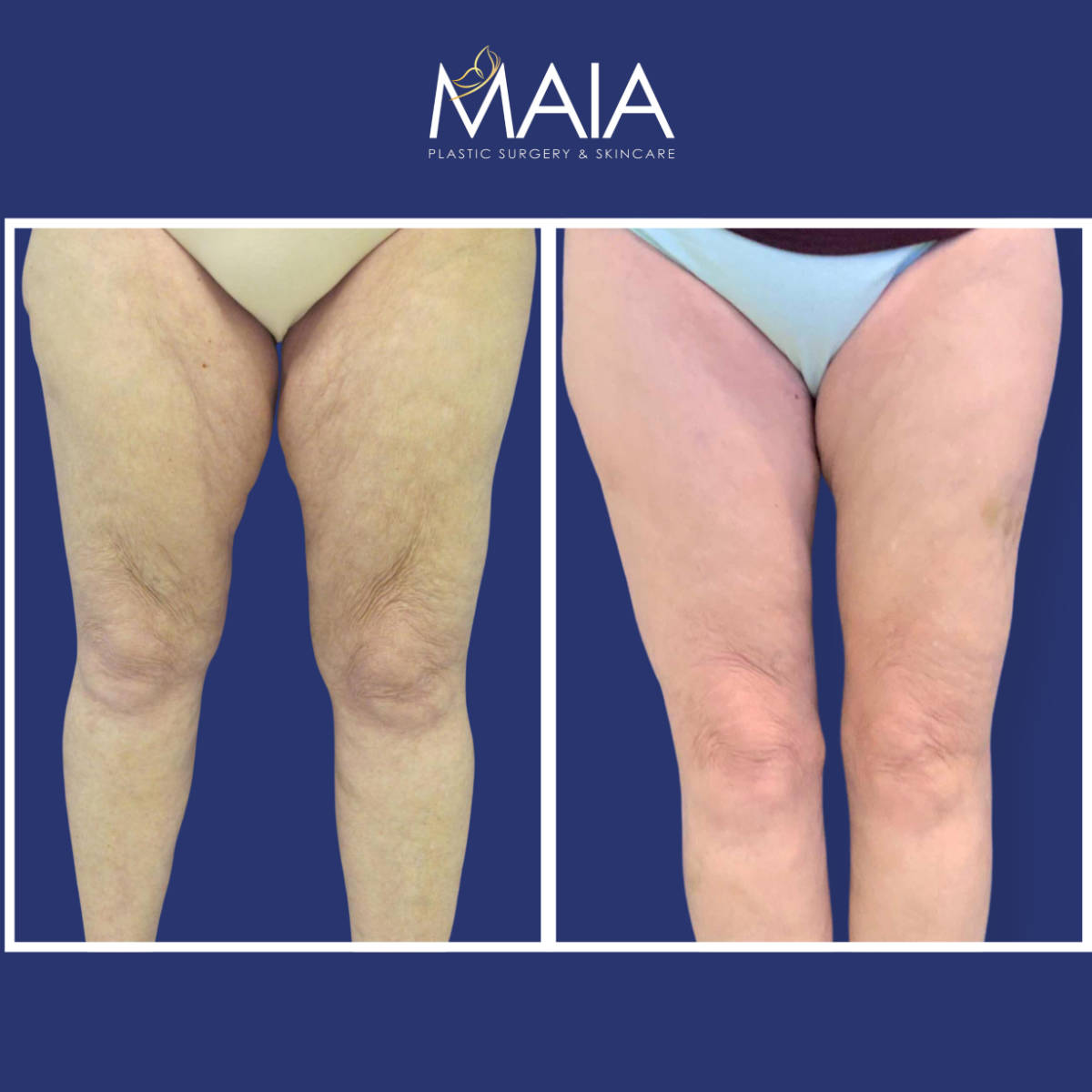 maia plastic surgery maia plastic surgery