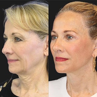 maia plastic surgery maia plastic surgery