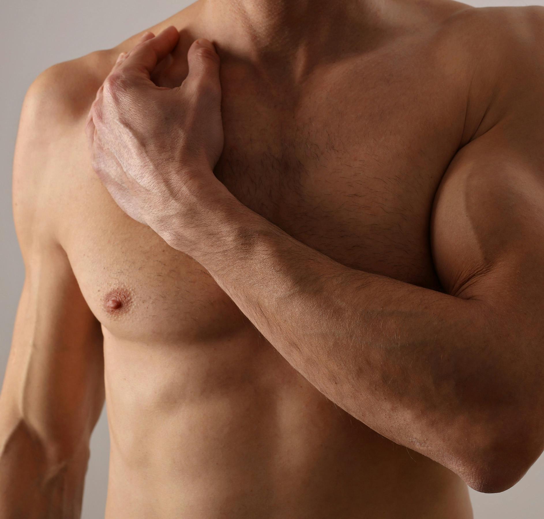 male gynecomastia male gynecomastia