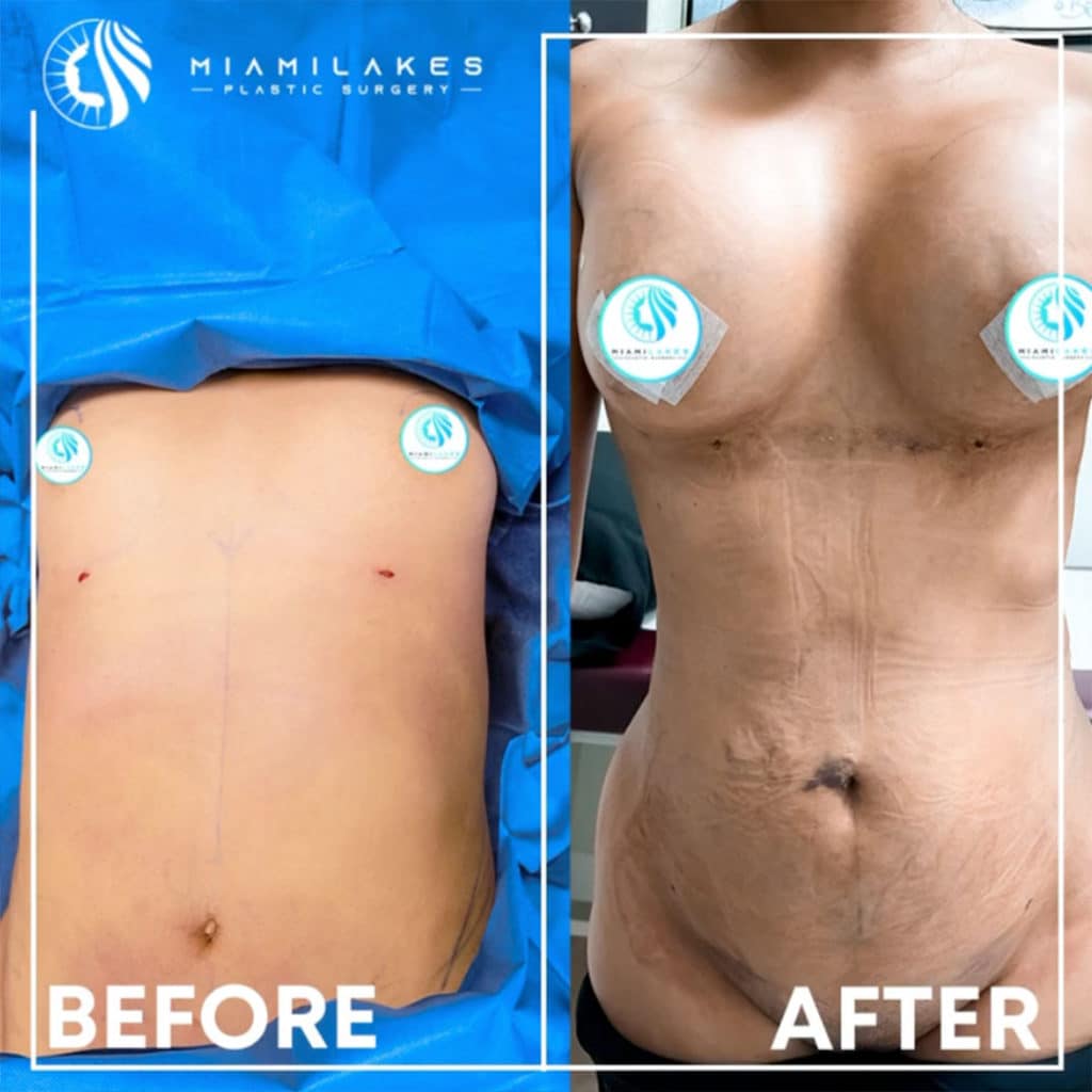 miami cosmetic surgery miami cosmetic surgery