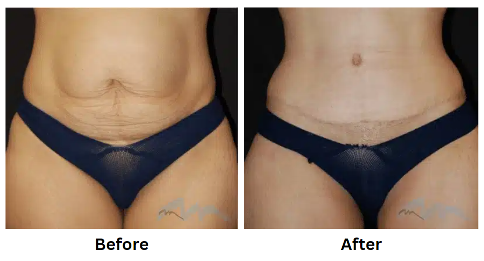 miami plastic surgery
