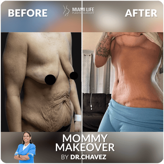 miami plastic surgery