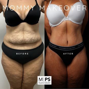 millennial plastic surgery millennial plastic surgery