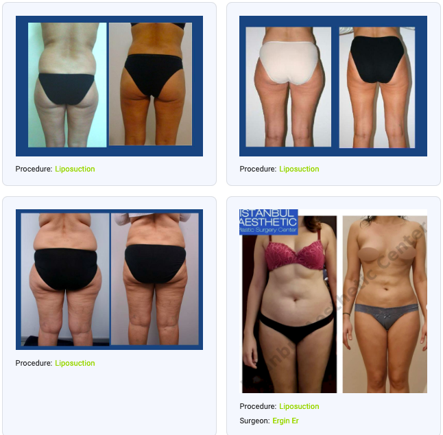 mommy makeover price mommy makeover price