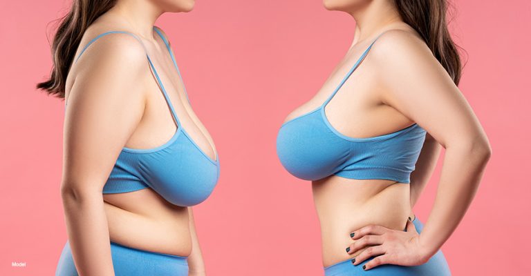 Natural Breast: Enhancing while keeping it natural