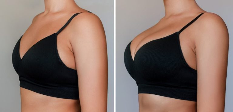 Natural breast enlargement methods: What really works