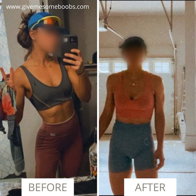 natural breast enlargement
