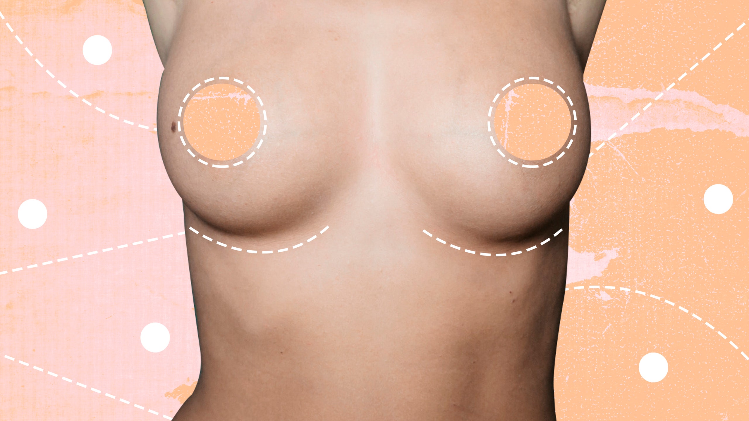 natural breast implants natural breast implants
