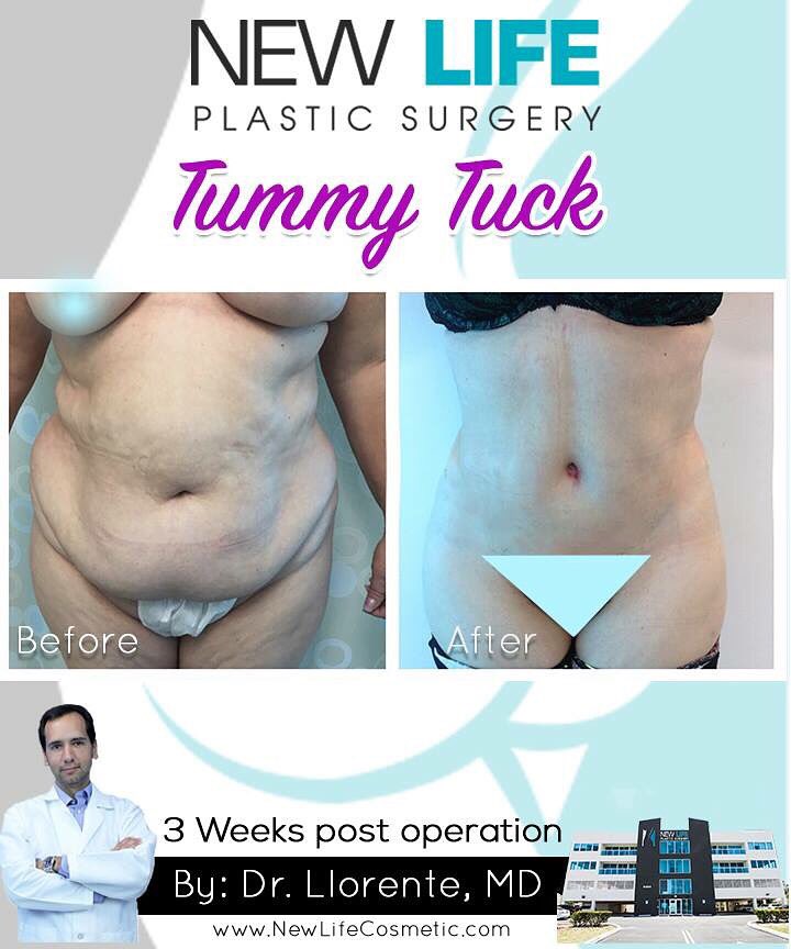 newlife plastic surgery newlife plastic surgery