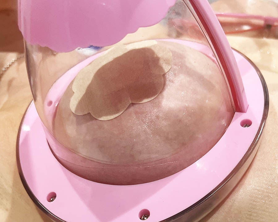 non invasive breast lift non invasive breast lift