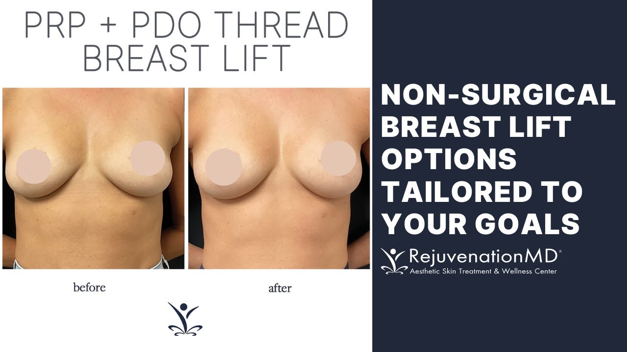 non surgical breast lift non surgical breast lift