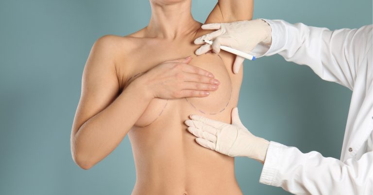Non-surgical breast lift: Achieving lift without incisions