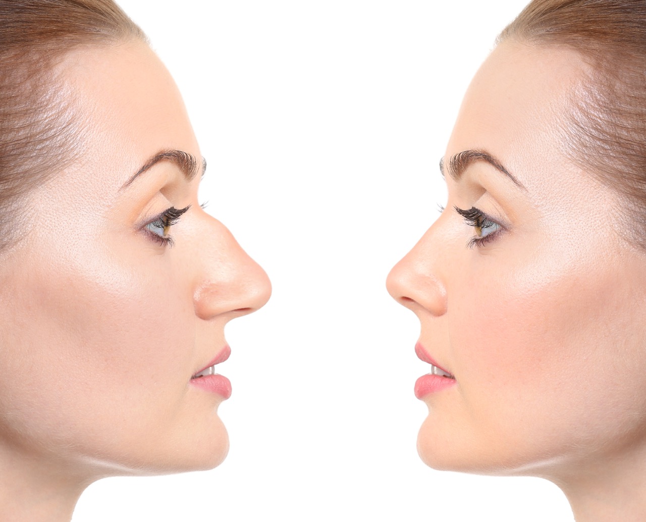 nose plastic surgery cost