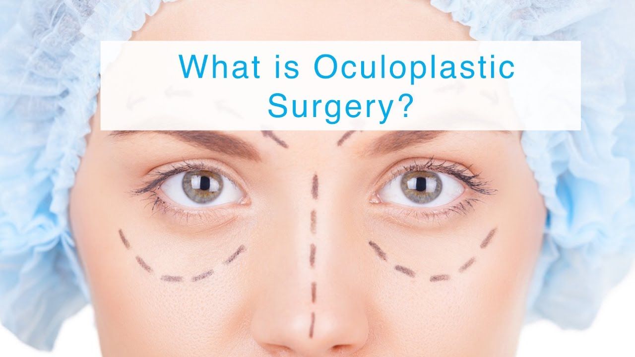 ophthalmic plastic surgery