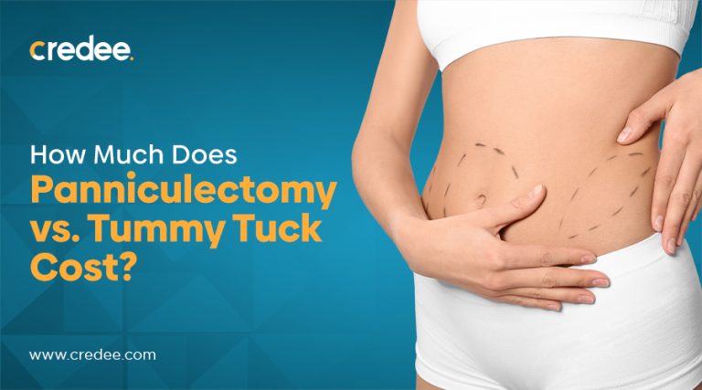 Panniculectomy Cost: Removing excess abdominal skin