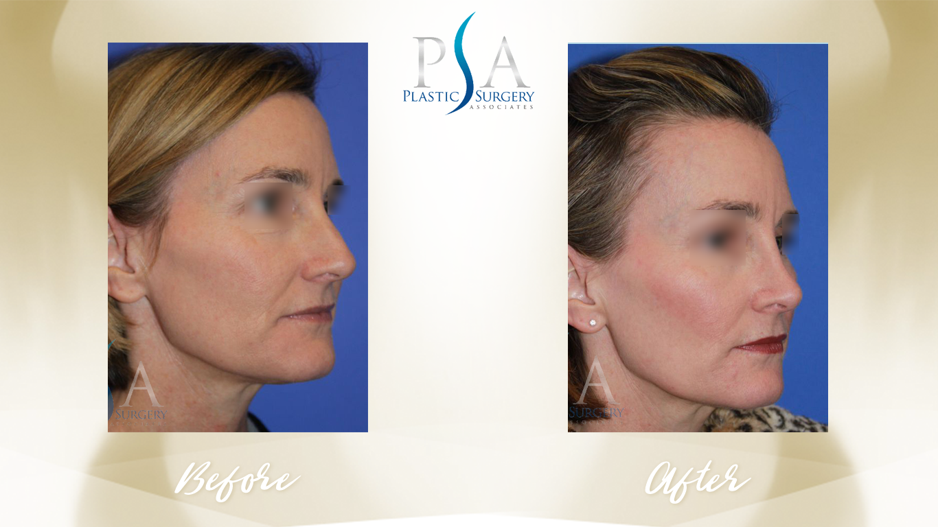 plastic surgery associates