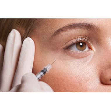 pmma injections