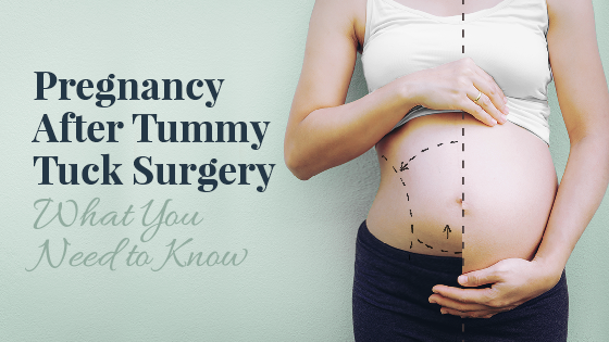 Pregnancy After Tummy Tuck: What you need to know