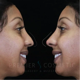 premier cosmetic surgery
