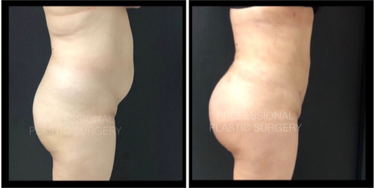professional plastic surgery