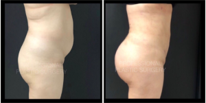 Professional Plastic Surgery: Expertise and patient care