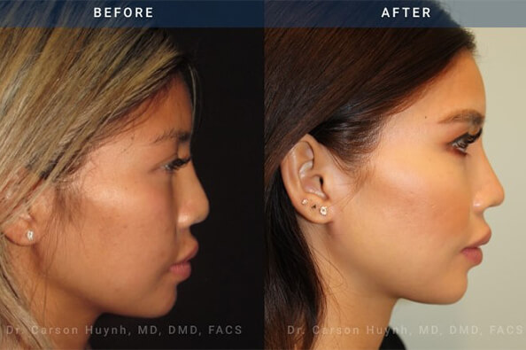 radiance plastic surgery radiance plastic surgery