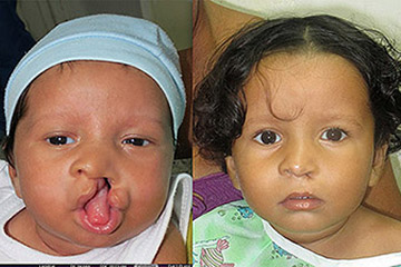 reconstructive plastic surgery reconstructive plastic surgery