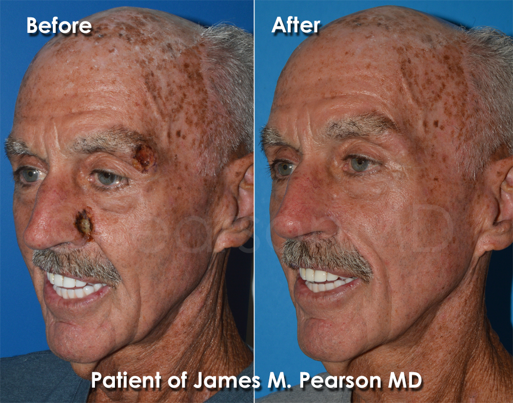 reconstructive plastic surgery reconstructive plastic surgery