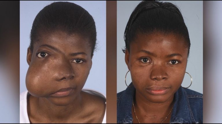 Reconstructive Plastic Surgery: Restoring form and function