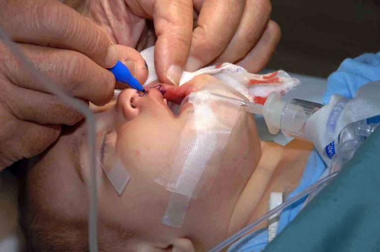 Reconstructive Surgery: Restoring form and function
