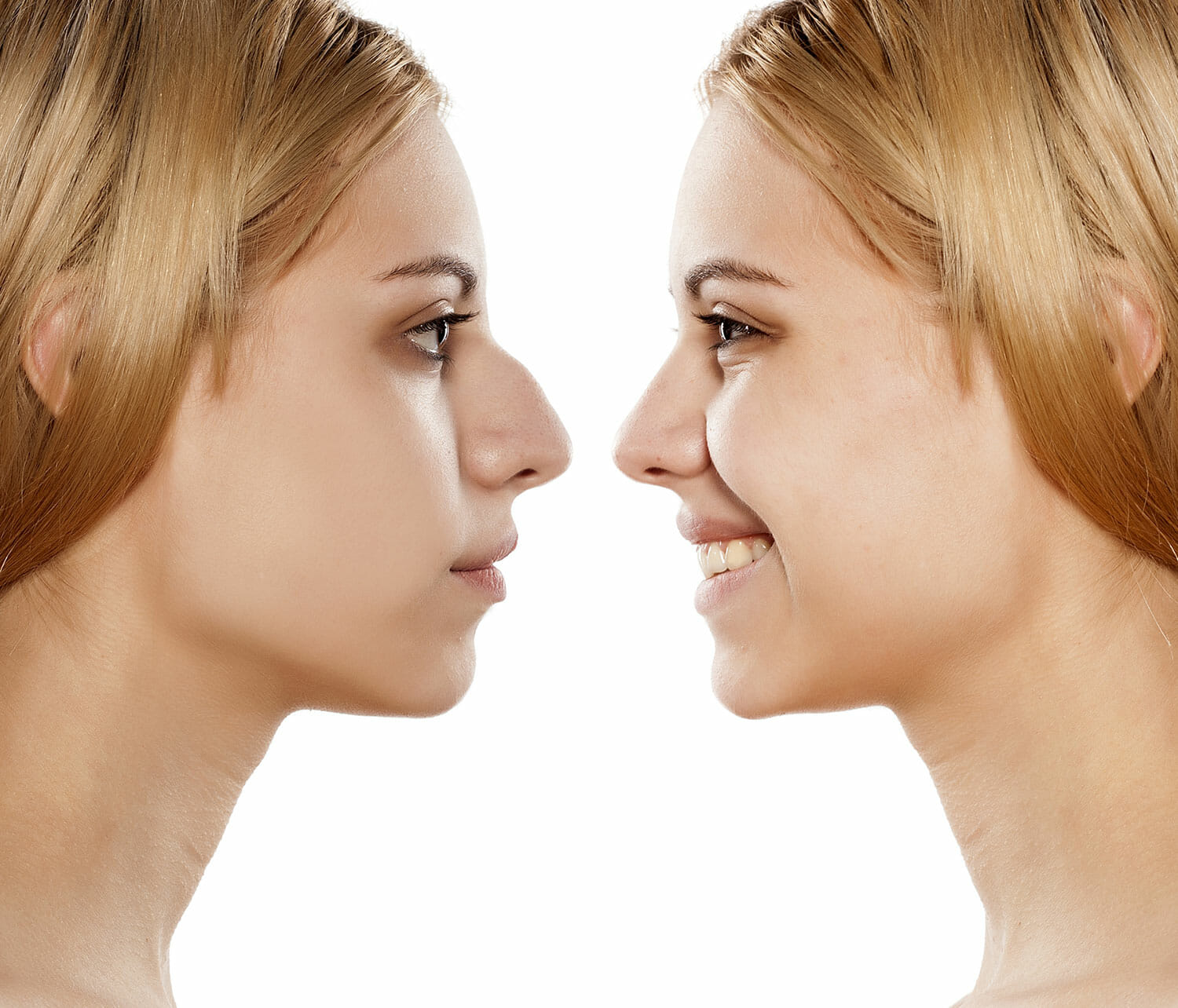 rhinoplasty price rhinoplasty price