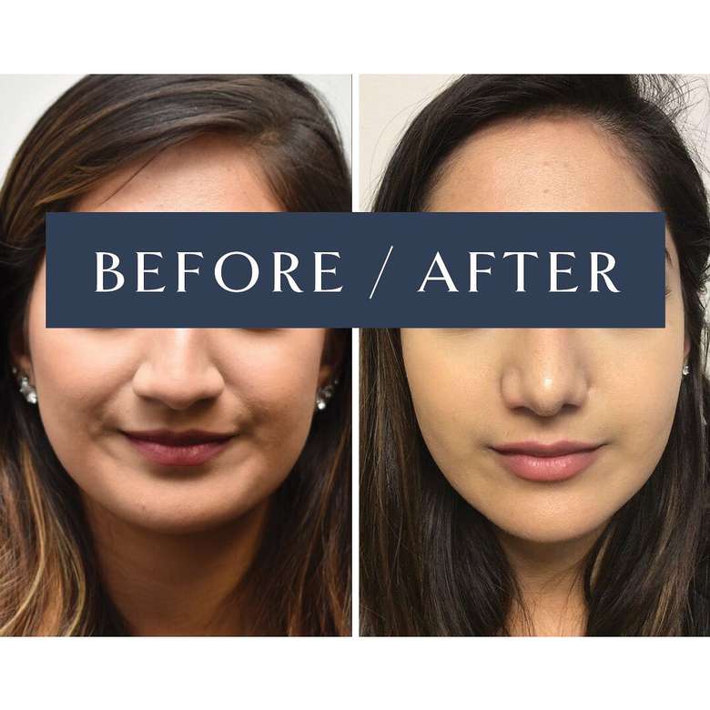 rockmore plastic surgery rockmore plastic surgery