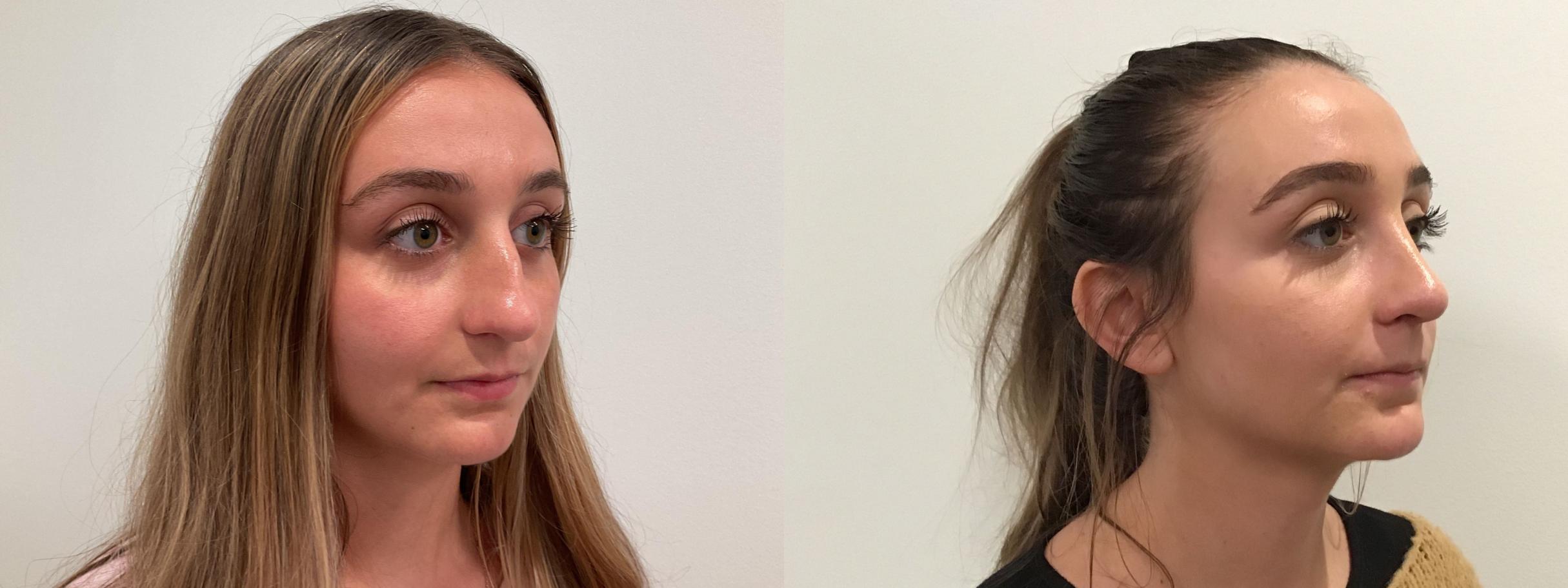 rockmore plastic surgery rockmore plastic surgery