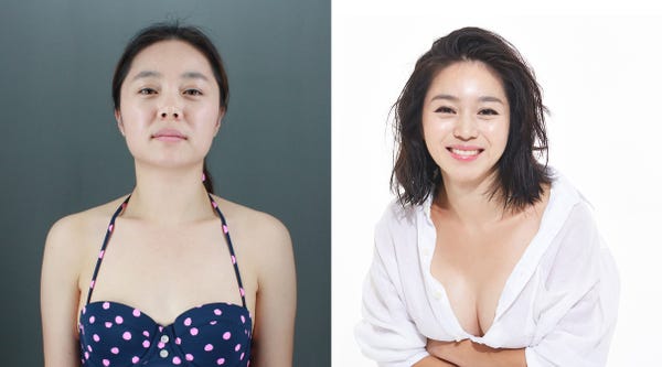 south korean plastic surgery south korean plastic surgery