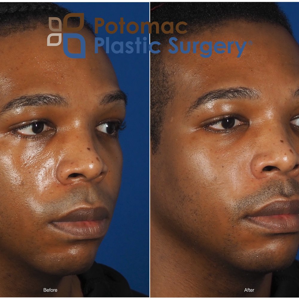 the best cosmetic surgeon the best cosmetic surgeon