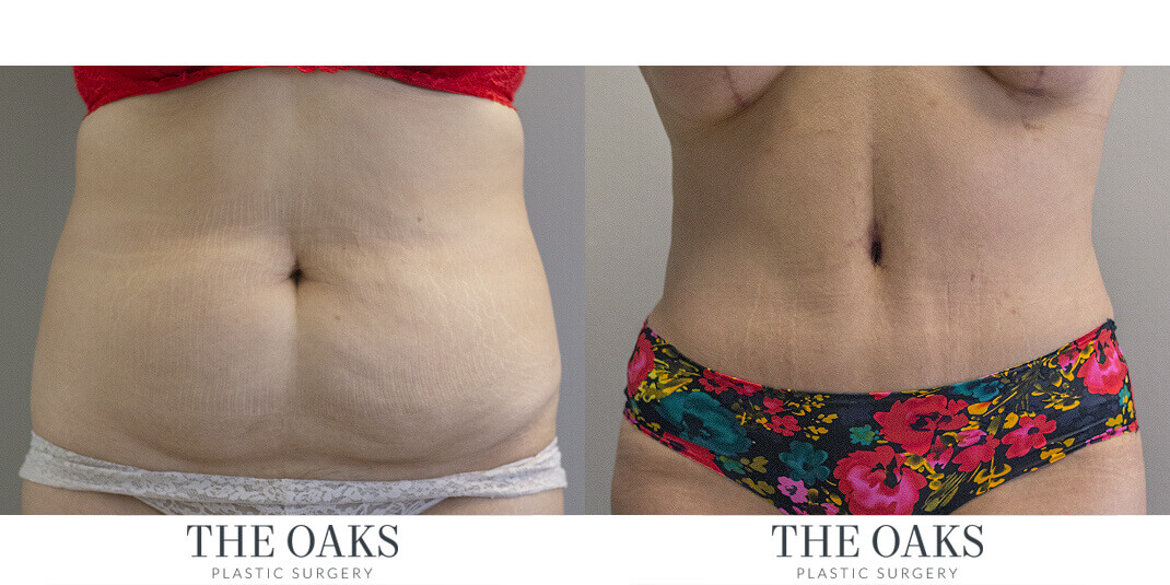 the oaks plastic surgery the oaks plastic surgery