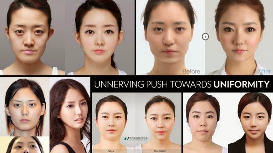 korean plastic surgery korean plastic surgery