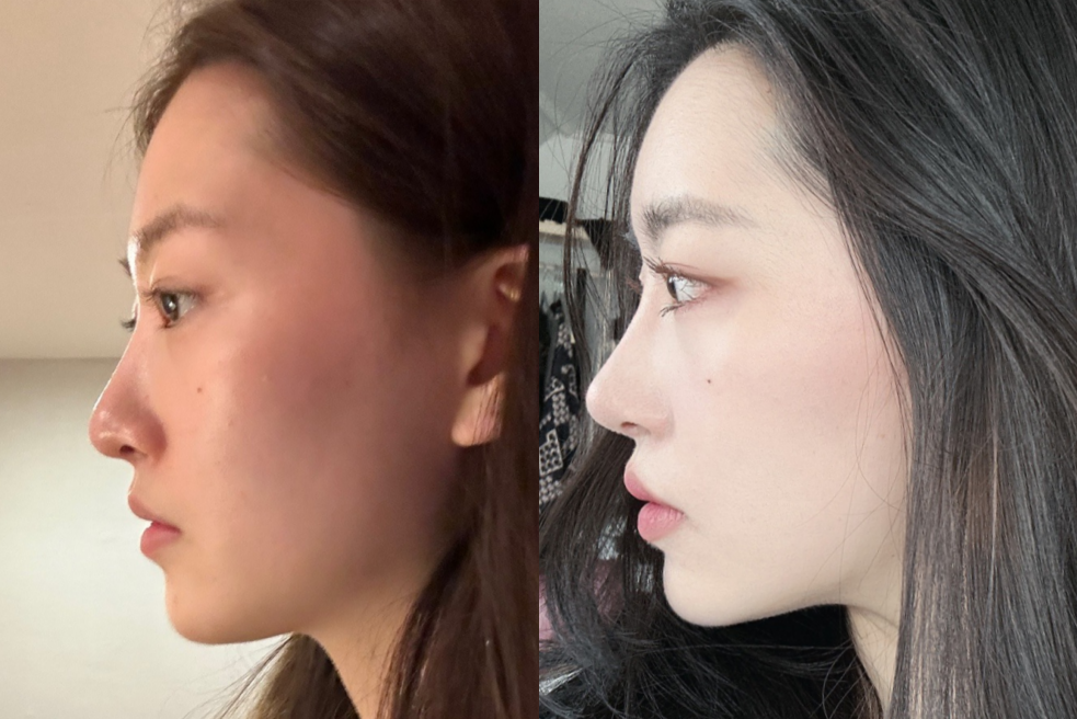 korean plastic surgery korean plastic surgery