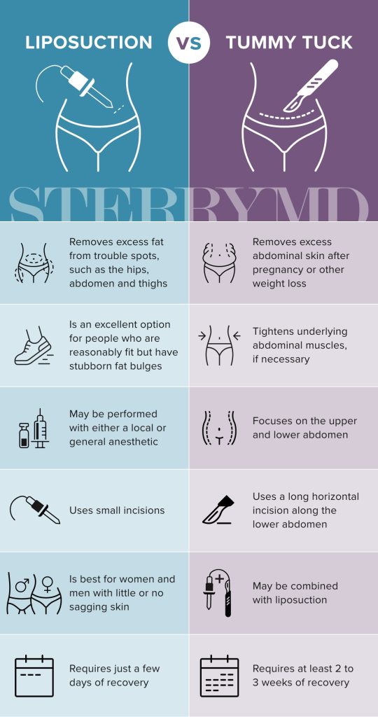 tummy tuck
