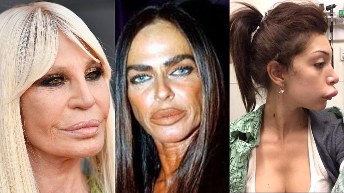 star plastic surgery star plastic surgery