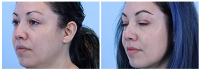 vennemeyer plastic surgery vennemeyer plastic surgery