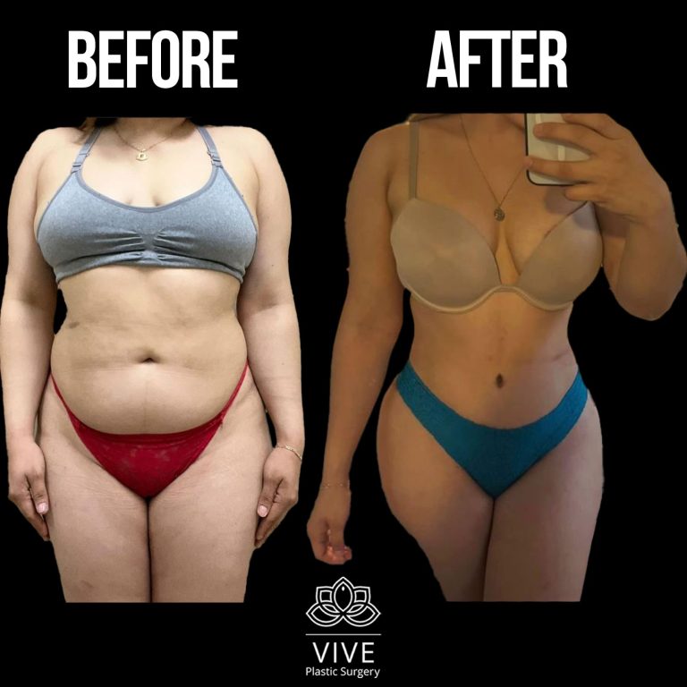 Vive Plastic Surgery: Excellence in transformative procedures