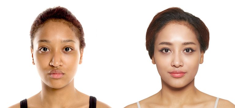 What to expect from JK plastic surgery in South Korea
