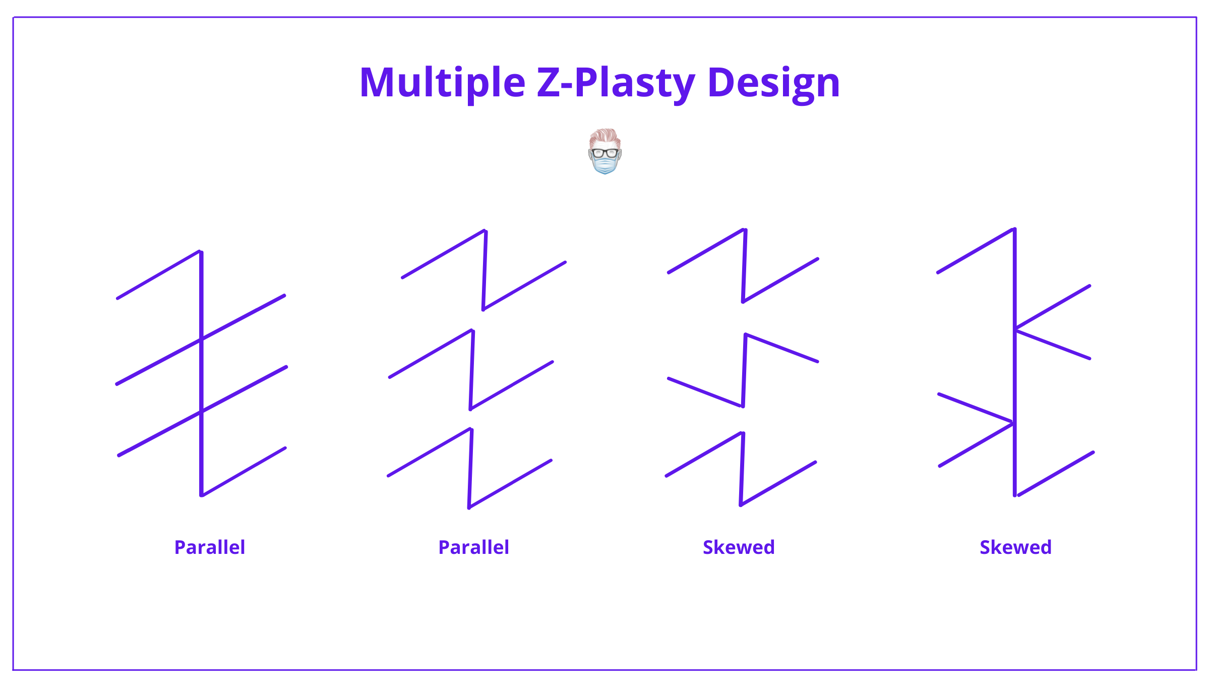 z plasty surgery